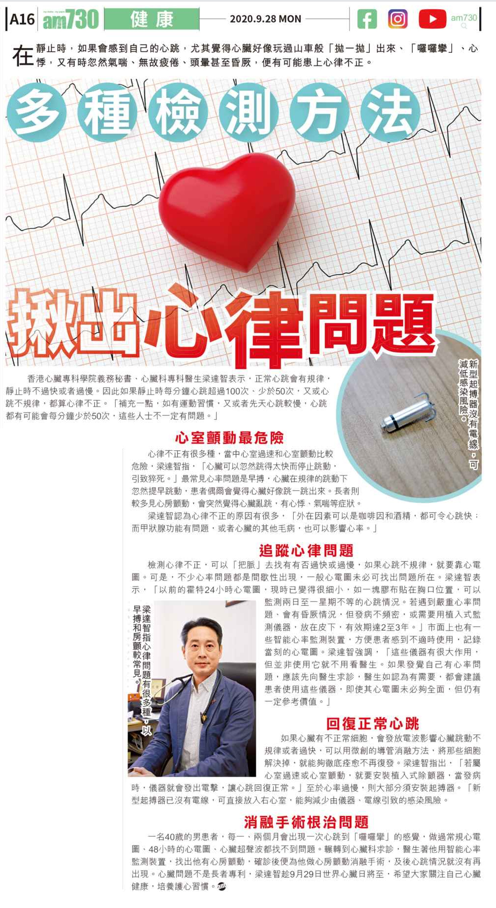 多種檢測方法 揪出心律問題